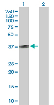 CD1B purified MaxPab rabbit polyclonal antibody (D01P)