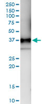 CD1B MaxPab rabbit polyclonal antibody (D01)
