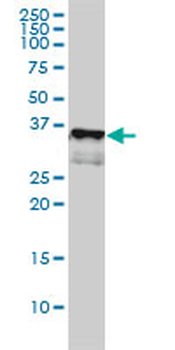 CD1A monoclonal antibody (M01), clone M1-2-1B5