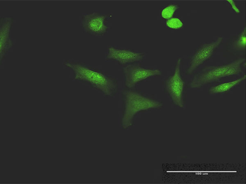 CCNT1 purified MaxPab mouse polyclonal antibody (B02P)