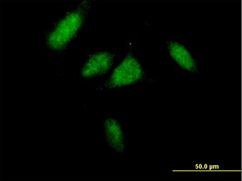 CCND3 purified MaxPab mouse polyclonal antibody (B01P)
