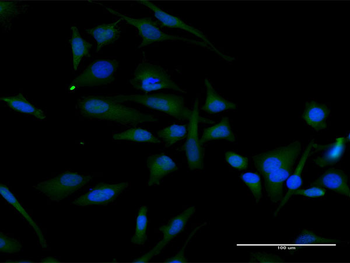 CCND2 MaxPab rabbit polyclonal antibody (D01)