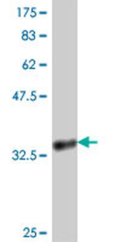 KRIT1 polyclonal antibody (A01)