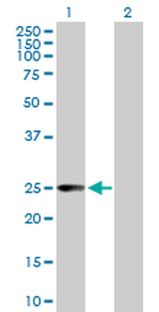 CCBL1 purified MaxPab mouse polyclonal antibody (B02P)