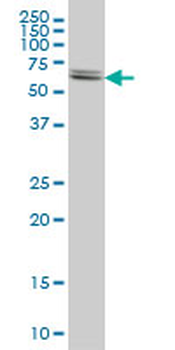 CBS monoclonal antibody (M01), clone 3E1
