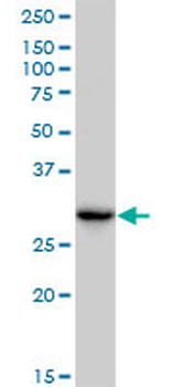 CBR3 monoclonal antibody (M05), clone 1G8
