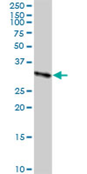 CBR3 purified MaxPab rabbit polyclonal antibody (D01P)