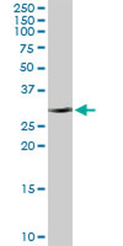 CBR1 MaxPab rabbit polyclonal antibody (D01)