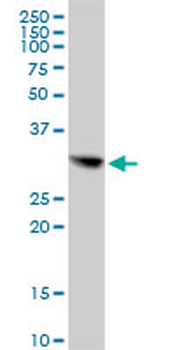 CBR1 purified MaxPab mouse polyclonal antibody (B01P)