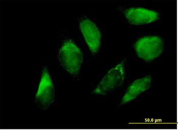 SERPINH1 purified MaxPab mouse polyclonal antibody (B01P)