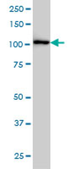 CBL monoclonal antibody (M01), clone 6D12