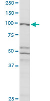 CBL MaxPab rabbit polyclonal antibody (D01)