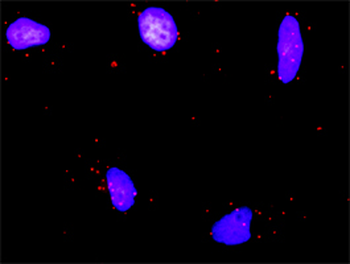 RUNX1T1 purified MaxPab rabbit polyclonal antibody (D01P)