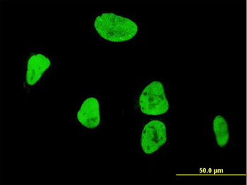 RUNX1 monoclonal antibody (M02), clone 3A1