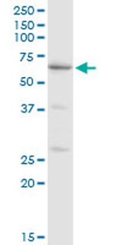 CAT MaxPab rabbit polyclonal antibody (D01)