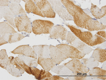 CASQ2 monoclonal antibody (M07), clone 1C6