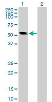 CASQ2 purified MaxPab rabbit polyclonal antibody (D01P)