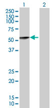 CASQ2 MaxPab mouse polyclonal antibody (B01P)