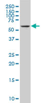 CASP10 polyclonal antibody (A01)