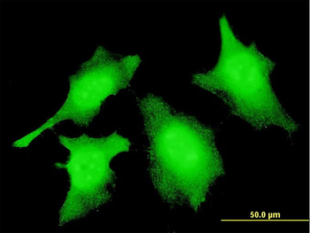 CASP2 monoclonal antibody (M10), clone 1C11