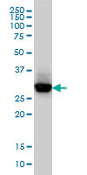 CAPZB monoclonal antibody (M03), clone 4H8