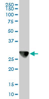 CAPZB monoclonal antibody (M02), clone 1H1
