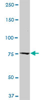 CAST monoclonal antibody (M03), clone 2C5
