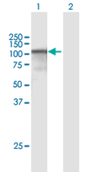 CAST purified MaxPab rabbit polyclonal antibody (D01P)