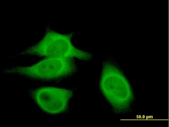 CAST purified MaxPab mouse polyclonal antibody (B01P)