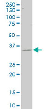 CAPZA2 polyclonal antibody (A01)