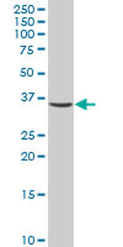 CAPZA1 polyclonal antibody (A02)