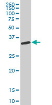 CAPZA1 polyclonal antibody (A01)