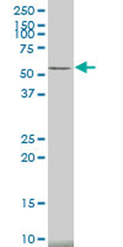 CAMK2A monoclonal antibody (M01), clone 2C4