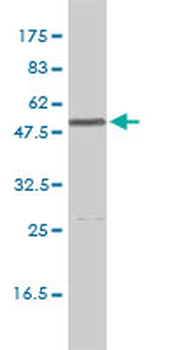CALR monoclonal antibody (M01), clone 1G11-1A9