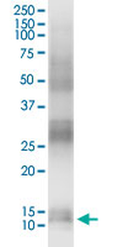 CALML3 MaxPab rabbit polyclonal antibody (D01)