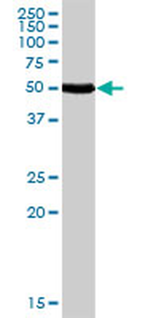 CALCR purified MaxPab rabbit polyclonal antibody (D01P)