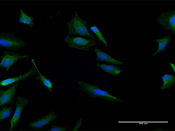 CALCB purified MaxPab mouse polyclonal antibody (B02P)