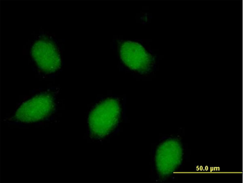 CALB1 purified MaxPab rabbit polyclonal antibody (D01P)