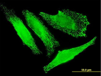 SLC25A20 monoclonal antibody (M02), clone M2