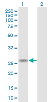CACNG1 purified MaxPab rabbit polyclonal antibody (D01P)