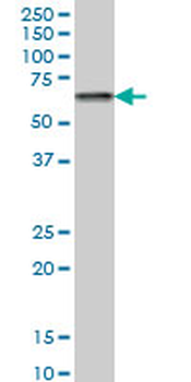 CACNB2 monoclonal antibody (M05), clone 6C4