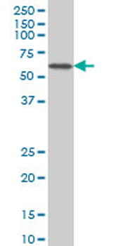 CACNB2 monoclonal antibody (M01), clone 6C1
