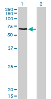 CACNB1 monoclonal antibody (M01), clone 1G6