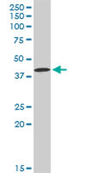 CA12 MaxPab rabbit polyclonal antibody (D01)