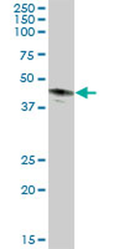 CA12 MaxPab mouse polyclonal antibody (B01P)