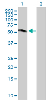 CA9 purified MaxPab rabbit polyclonal antibody (D01P)