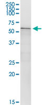 CA9 MaxPab rabbit polyclonal antibody (D01)