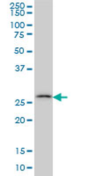 CA7 monoclonal antibody (M06), clone 3B7