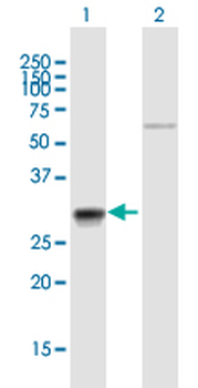 CA7 purified MaxPab mouse polyclonal antibody (B01P)