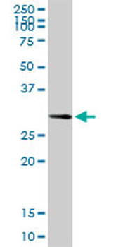 CA3 purified MaxPab rabbit polyclonal antibody (D01P)
